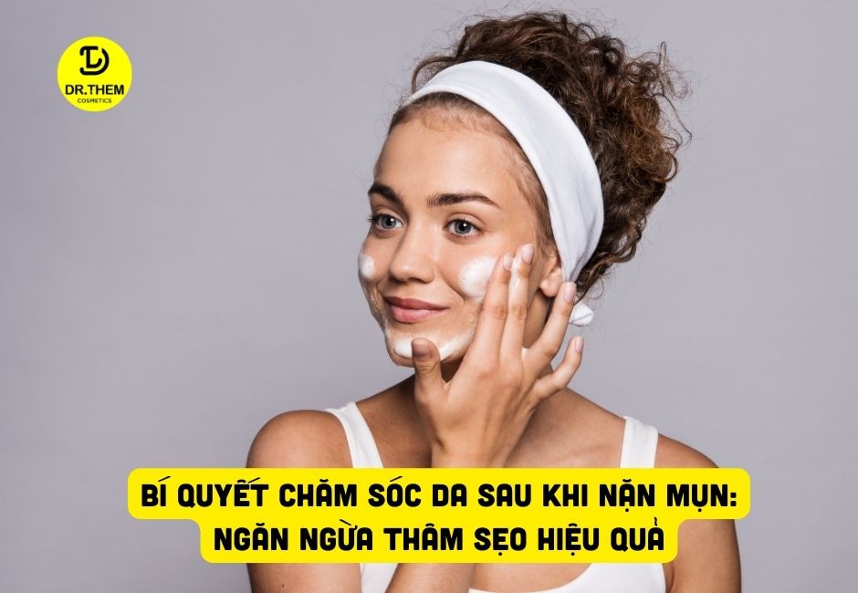 Bí Quyết Chăm Sóc Da Sau Khi Nặn Mụn: Ngăn Ngừa Thâm Sẹo Hiệu Quả